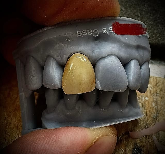 Finished crowns and bridges