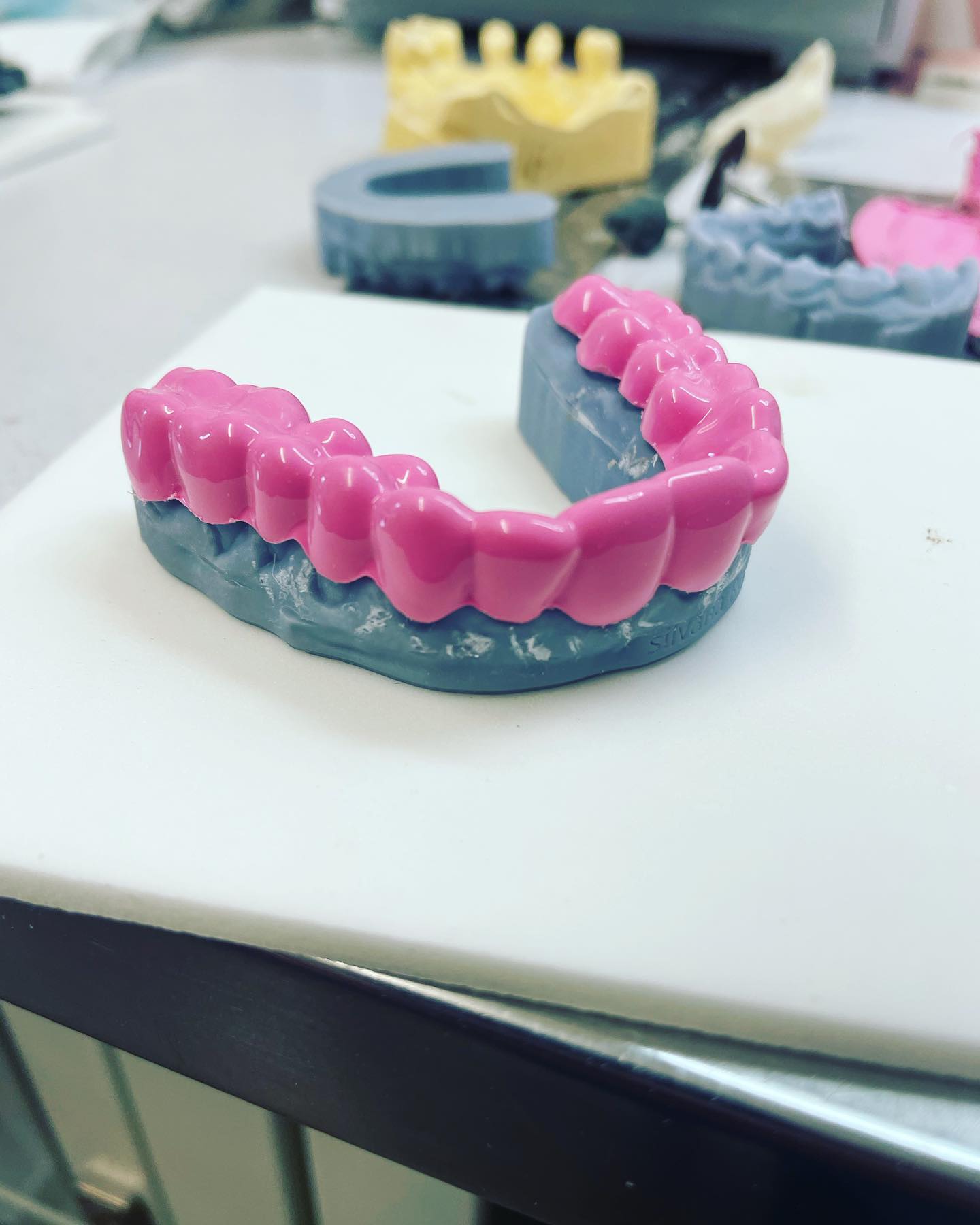 Orthodontic appliance in production